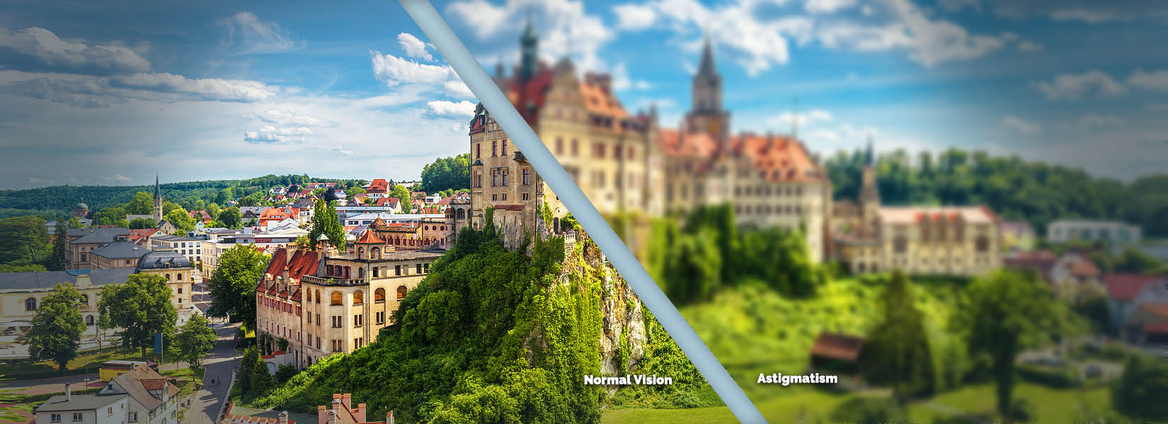 Astigmatism Treatment in Missouri City