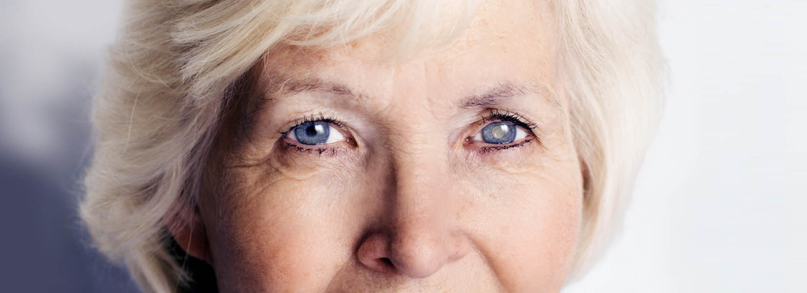 Cataract Surgery in Missouri City